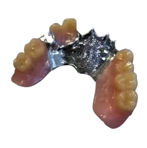 Partial removable dentures