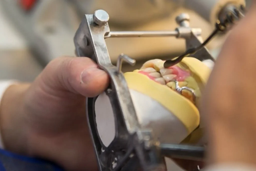 Dentures being made