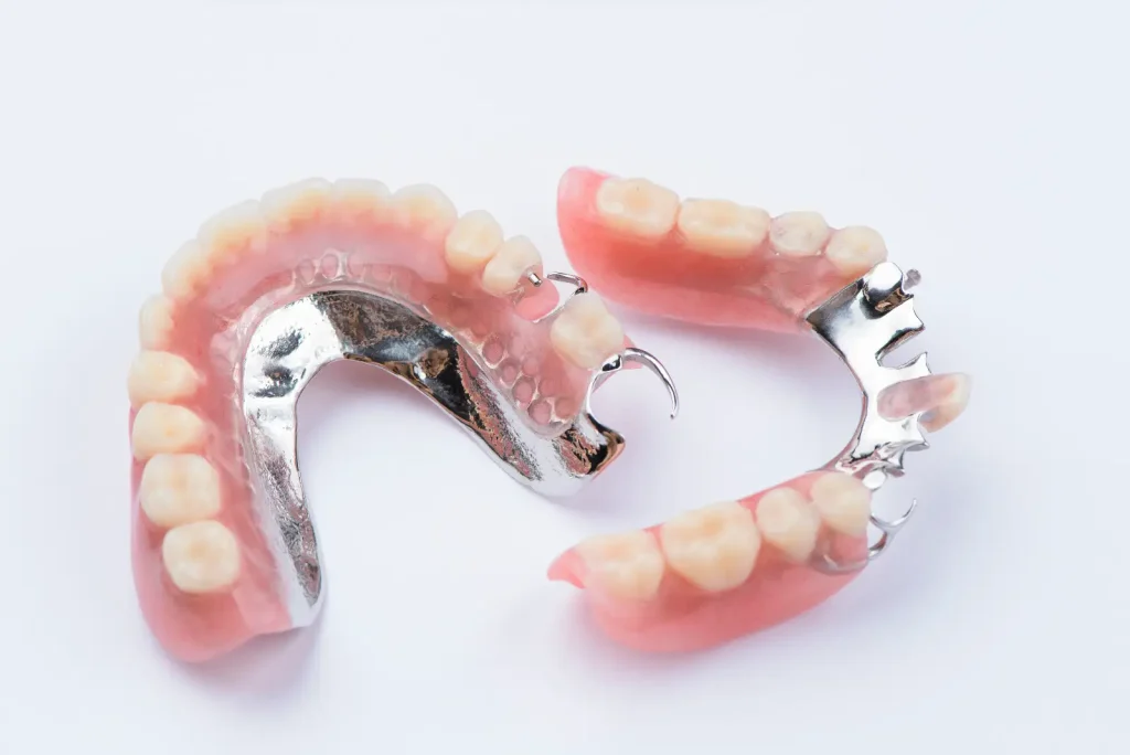 Partial Denture by Alex Hupka, Denturist